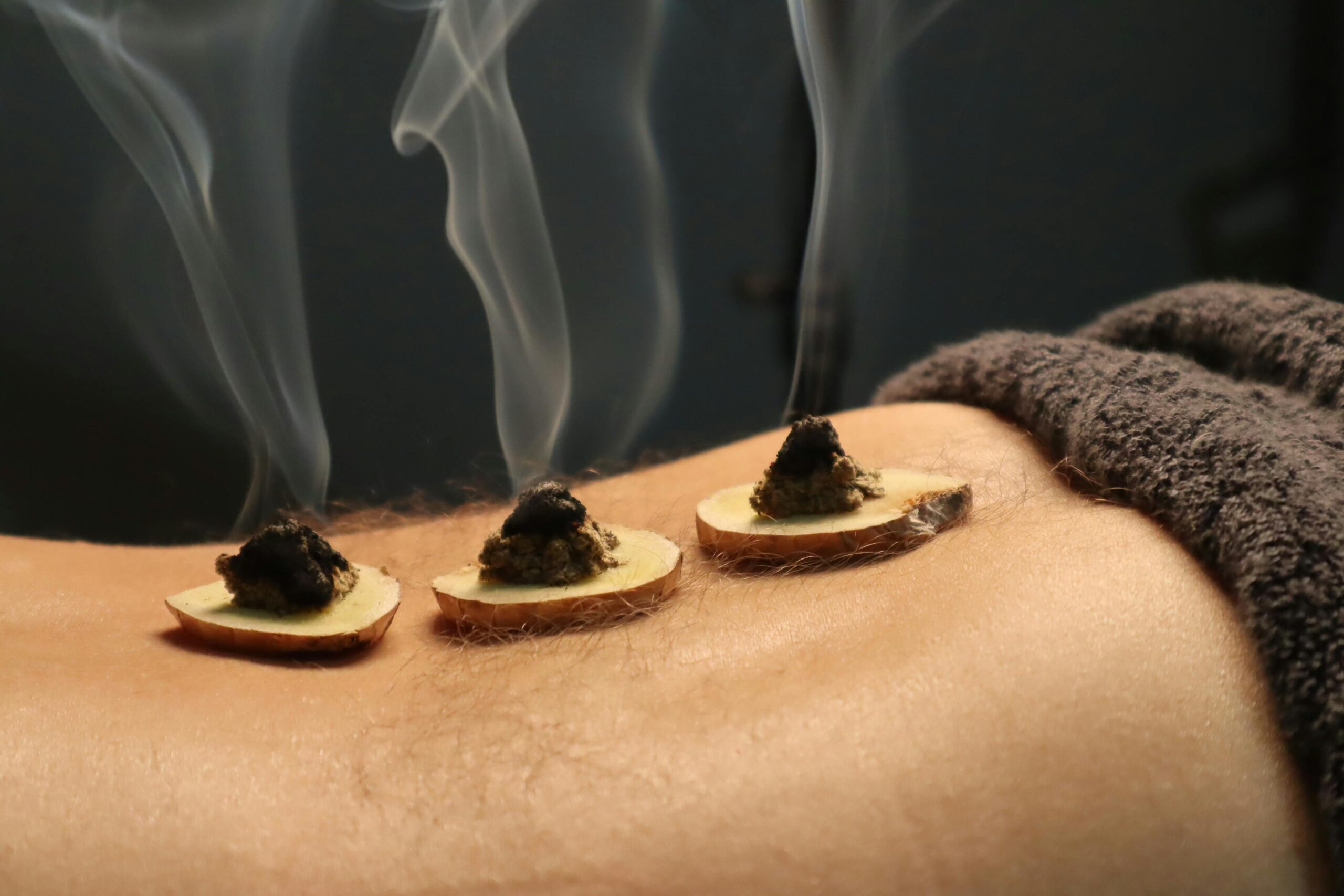 Holistic Therapies: Acupuncture and Moxibustion in Fertility Preparation